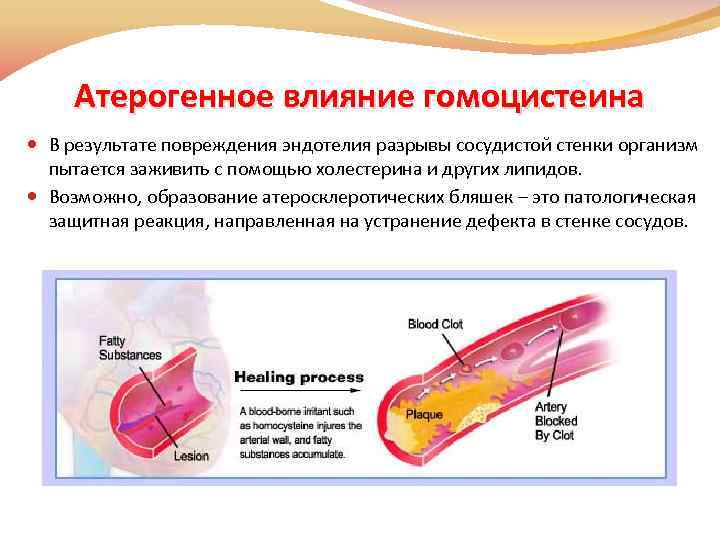 Повреждение сосудистой стенки