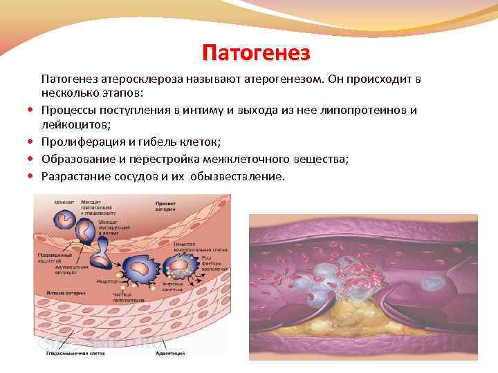 Патогенез Патогенез атеросклероза называют атерогенезом. Он происходит в несколько этапов: Процессы поступления в интиму