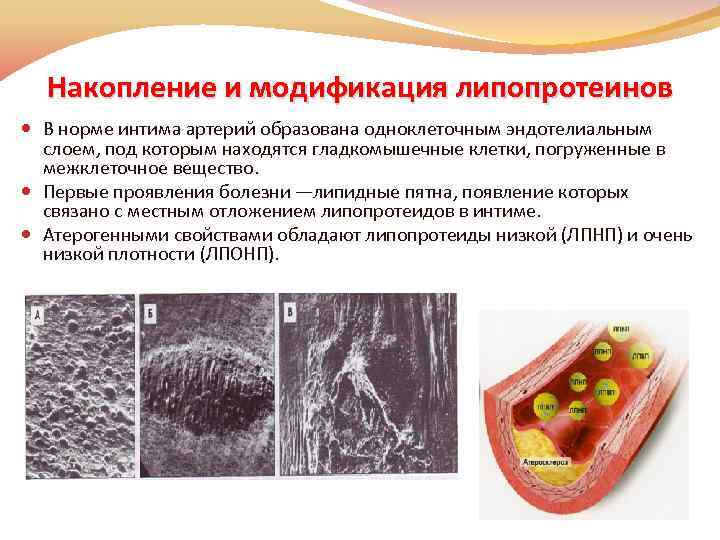 Накопление и модификация липопротеинов В норме интима артерий образована одноклеточным эндотелиальным слоем, под которым