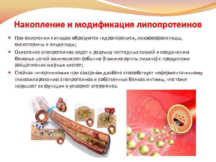 Накопление и модификация липопротеинов При окислении липидов образуются гидроперекиси, лизофосфолипиды, оксистерины и альдегиды; Окисление