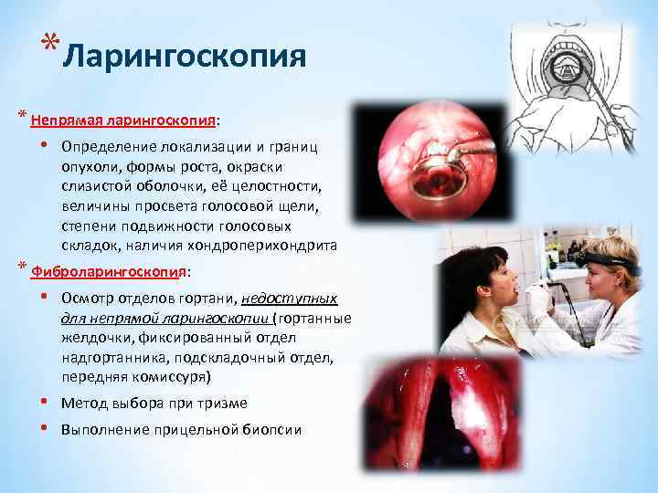 *Ларингоскопия * Непрямая ларингоскопия: • Определение локализации и границ опухоли, формы роста, окраски слизистой