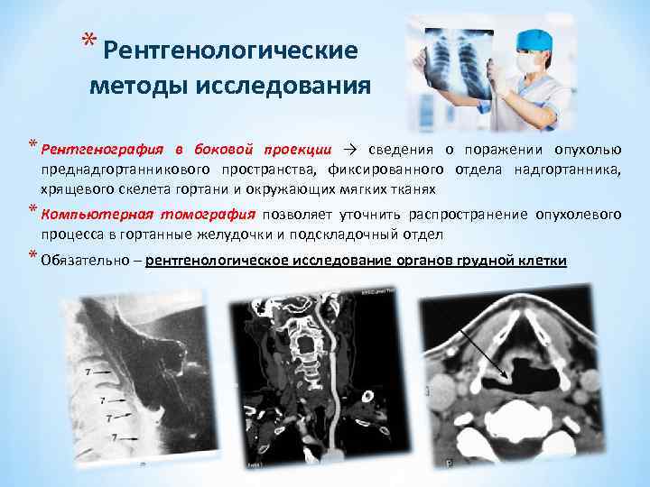 * Рентгенологические методы исследования * Рентгенография в боковой проекции → сведения о поражении опухолью