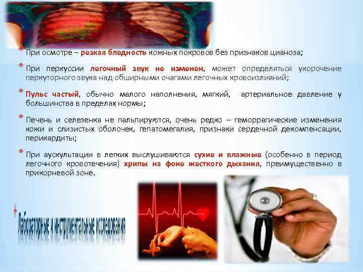* При осмотре – резкая бледность кожных покровов без признаков цианоза; * При перкуссии