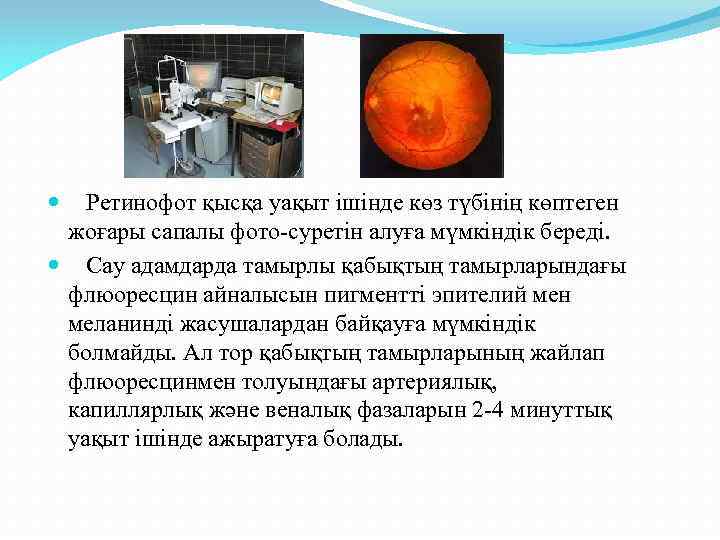 Ретинофот қысқа уақыт ішінде көз түбінің көптеген жоғары сапалы фото-суретін алуға мүмкіндік береді. Сау