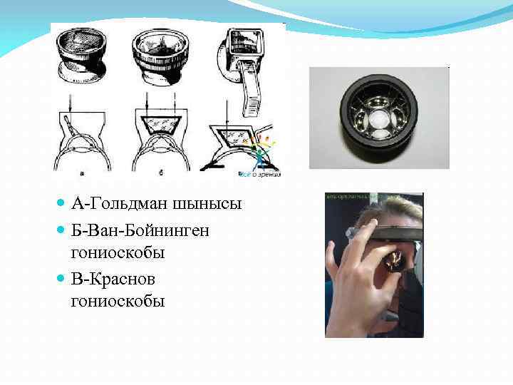 А-Гольдман шынысы Б-Ван-Бойнинген гониоскобы В-Краснов гониоскобы 