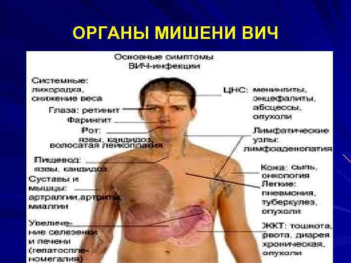 ОРГАНЫ МИШЕНИ ВИЧ 