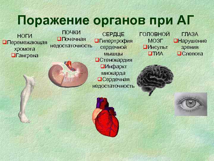 Поражение органов при АГ ПОЧКИ СЕРДЦЕ ГОЛОВНОЙ ГЛАЗА НОГИ q. Почечная q. Гипертрофия МОЗГ