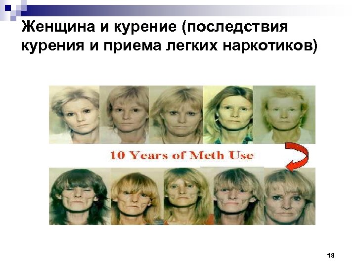 Женщина и курение (последствия курения и приема легких наркотиков) 18 
