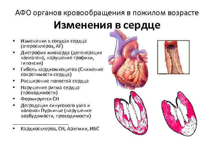 Сердечный измениться. Возрастные изменения сердца. Возрастные изменения сердечно-сосудистой системы. Изменения сердечно-сосудистой системы у пожилых людей. Возрастные изменения сердца человека.