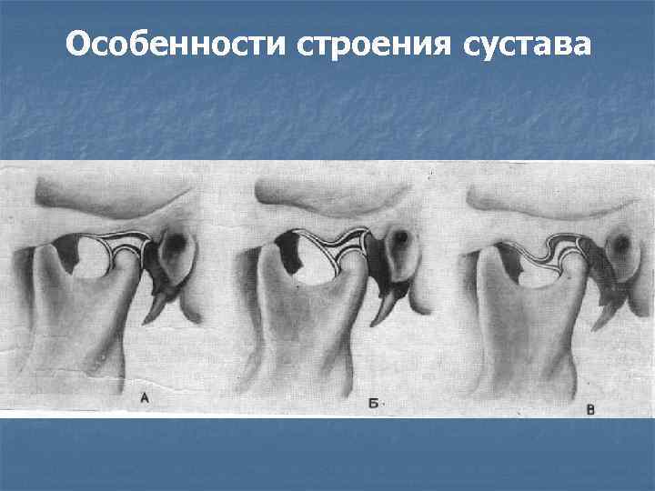 Особенности строения сустава 