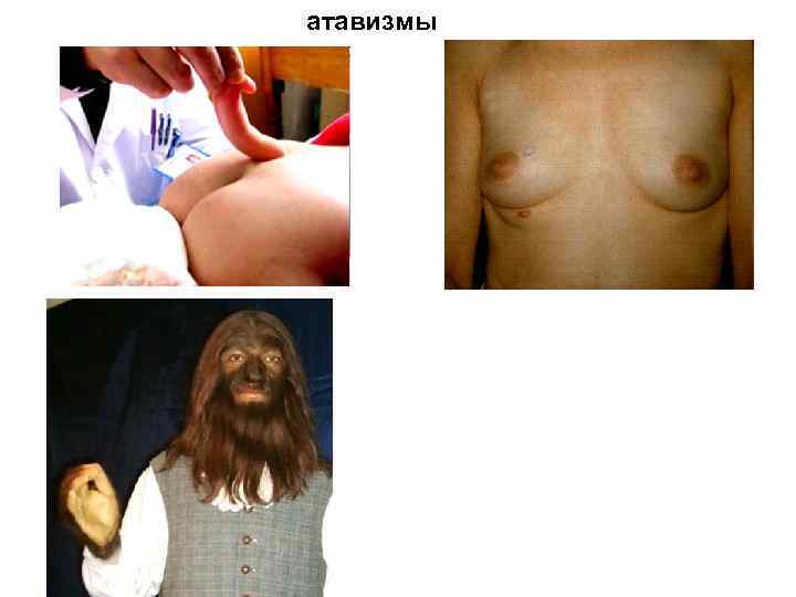 атавизмы 