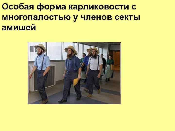 Особая форма карликовости с многопалостью у членов секты амишей 