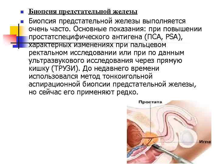 n n Биопсия предстательной железы выполняется очень часто. Основные показания: при повышении простатспецифического антигена