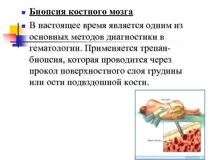 n n Биопсия костного мозга В настоящее время является одним из основных методов диагностики