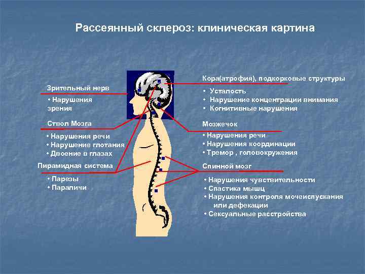 Рассеянный склероз: клиническая картина Зрительный нерв • Нарушения зрения Ствол Мозга • Нарушения речи