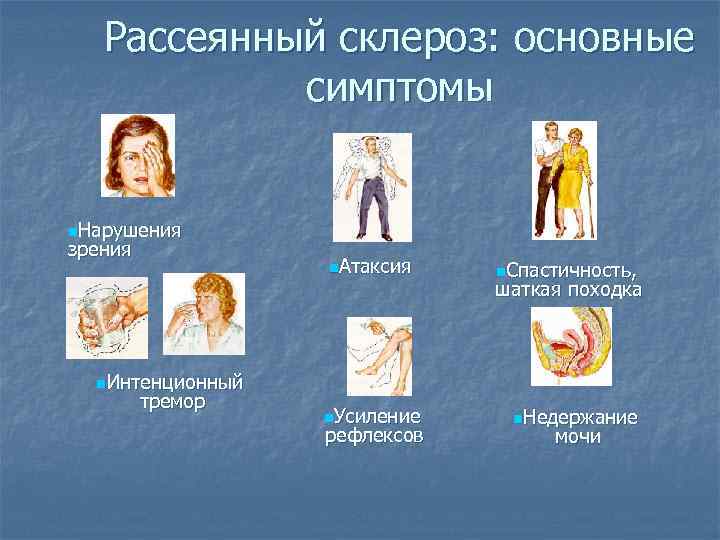 Рассеянный склероз: основные симптомы n. Нарушения зрения n. Атаксия n. Спастичность, шаткая походка n.