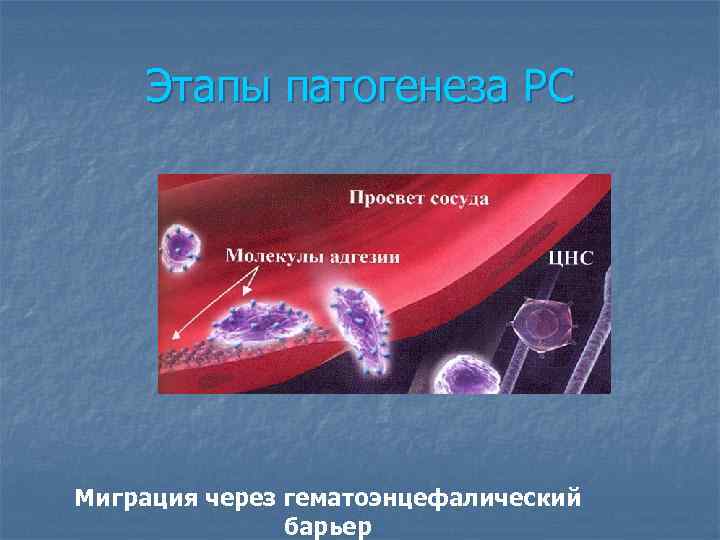 Этапы патогенеза РС Миграция через гематоэнцефалический барьер 