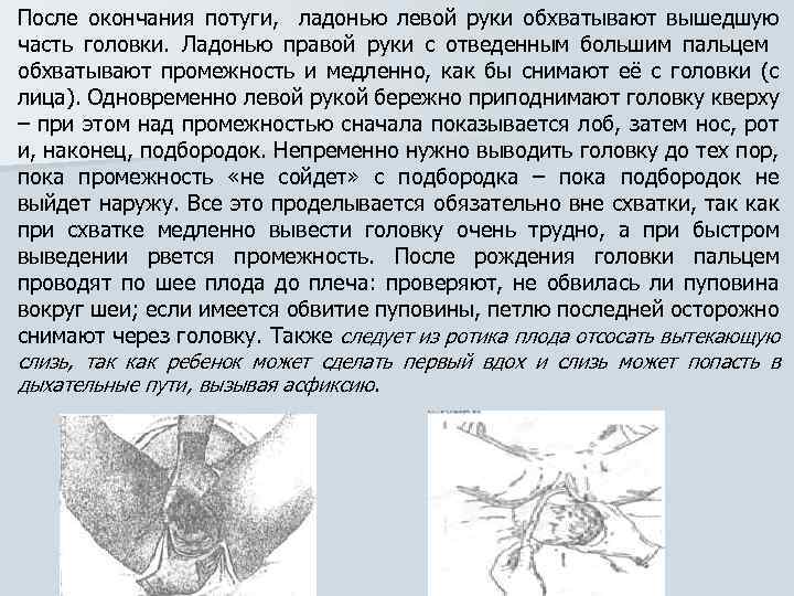 После окончания потуги, ладонью левой руки обхватывают вышедшую часть головки. Ладонью правой руки с