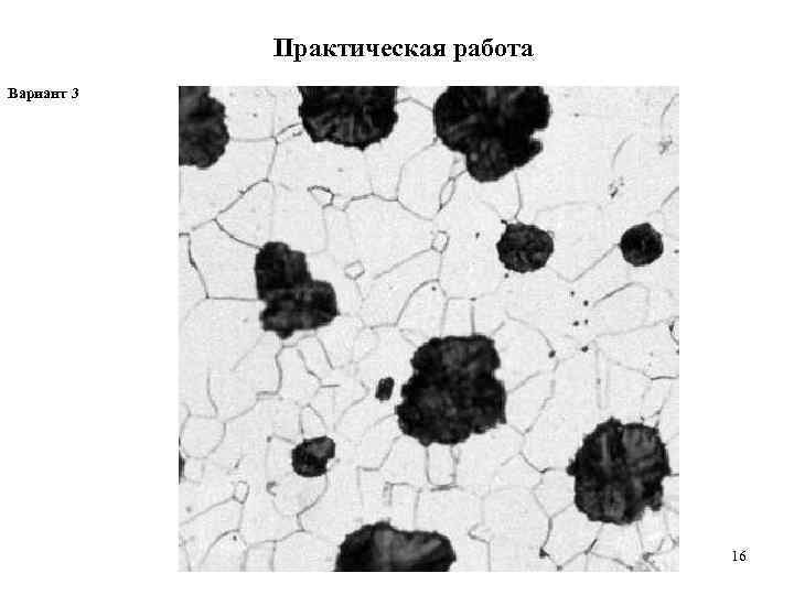 Высокопрочном чугуне графит. Структура высокопрочного ферритного чугуна. Ковкий чугун микроструктура. Чугун с шаровидным графитом структуры. Микроструктура высокопрочного чугуна.