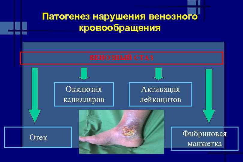 Факторы способствующие венозному кровотоку. Нарушение венозного кровообращения. Острые и хронические нарушения венозного кровообращения. Патогенез венозной гиперемии. Нарушения венозного кровообращения патология.