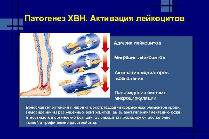 Нарушение венозного. Патогенез венозной недостаточности. Патогенез хронической венозной недостаточности. Хроническая венозная недостаточность развивается. Патогенез ХВН нижних конечностей.