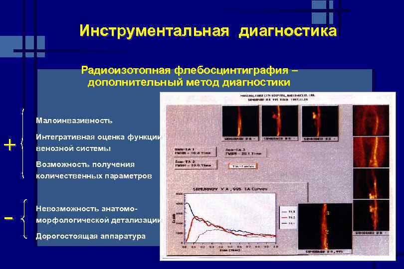 Инструментальная диагностика Радиоизотопная флебосцинтиграфия – дополнительный метод диагностики Малоинвазивность + Интегративная оценка функции венозной