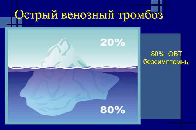 Острый венозный тромбоз 80% ОВТ безсимптомны 