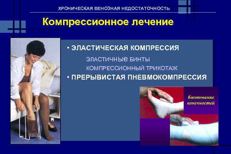 ХРОНИЧЕСКАЯ ВЕНОЗНАЯ НЕДОСТАТОЧНОСТЬ Компрессионное лечение • ЭЛАСТИЧЕСКАЯ КОМПРЕССИЯ ЭЛАСТИЧные БИНТЫ КОМПРЕССИОННЫЙ ТРИКОТАЖ • ПРЕРЫВИСТАЯ
