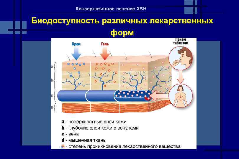 Консервативное лечение ХВН Биодоступность различных лекарственных форм 