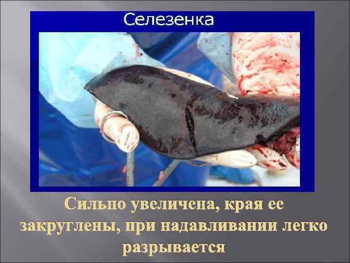 Сильно увеличена, края ее закруглены, при надавливании легко разрывается 