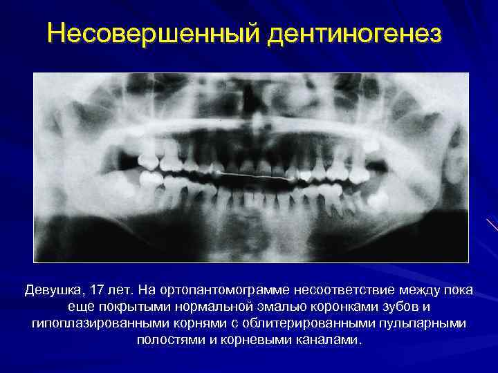 Схема описания ортопантомограммы