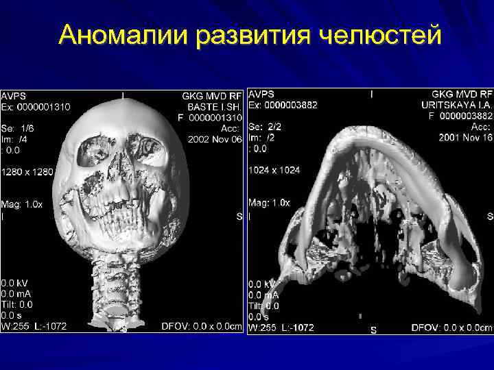 Системные аномалии в компьютере что это