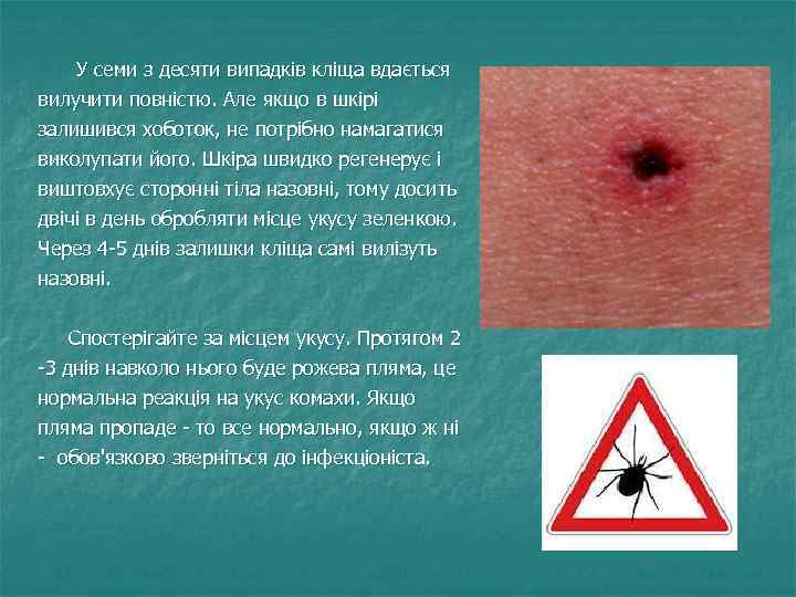  У семи з десяти випадків кліща вдається вилучити повністю. Але якщо в шкірі