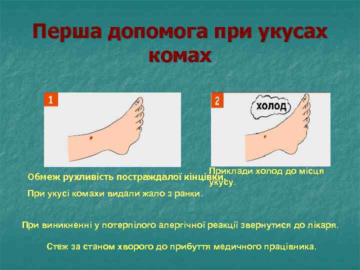 Перша допомога при укусах комах Приклади холод до місця Обмеж рухливість постраждалої кінцівки. укусу.