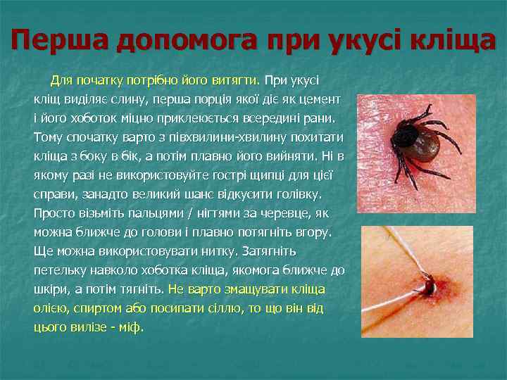 Перша допомога при укусі кліща Для початку потрібно його витягти. При укусі кліщ виділяє