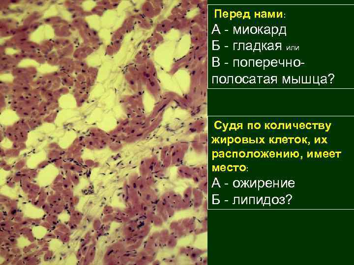 Перед нами: А - миокард Б - гладкая или В - поперечнополосатая мышца? Судя