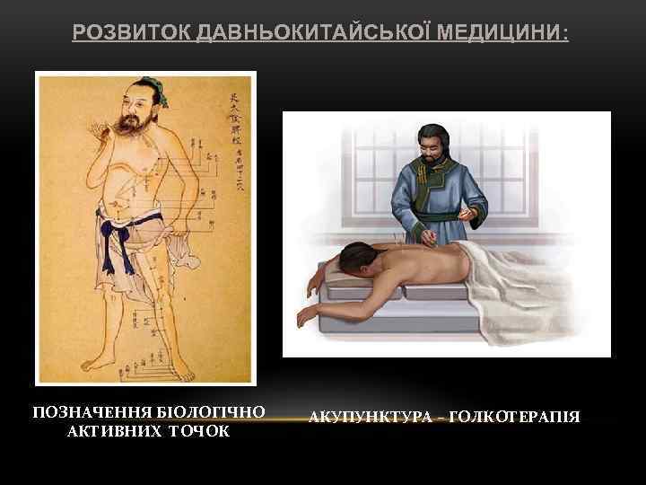 РОЗВИТОК ДАВНЬОКИТАЙСЬКОЇ МЕДИЦИНИ: ПОЗНАЧЕННЯ БІОЛОГІЧНО АКТИВНИХ ТОЧОК АКУПУНКТУРА – ГОЛКОТЕРАПІЯ 