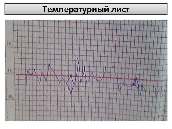 Как отметить пульс на температурном листе образец