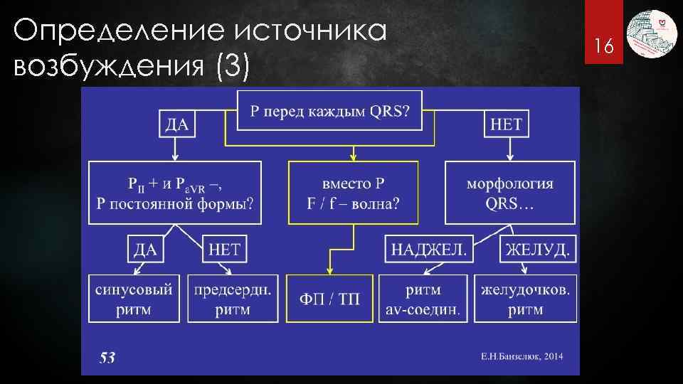 Определение источника возбуждения (3) 16 