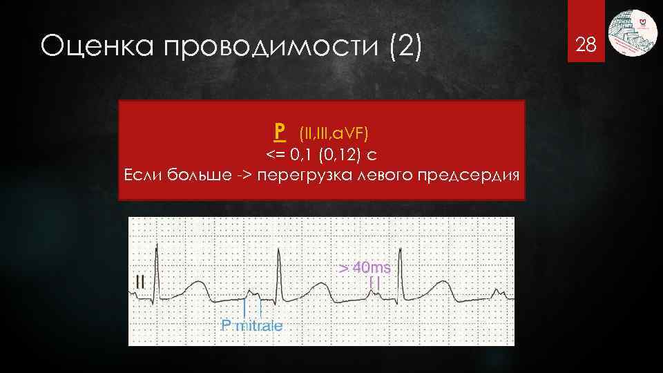 Оценка проводимости (2) P (II, III, a. VF) <= 0, 1 (0, 12) с