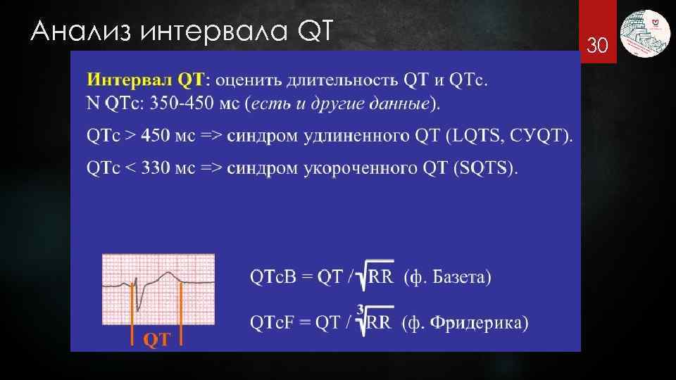 Анализ интервала QT 30 