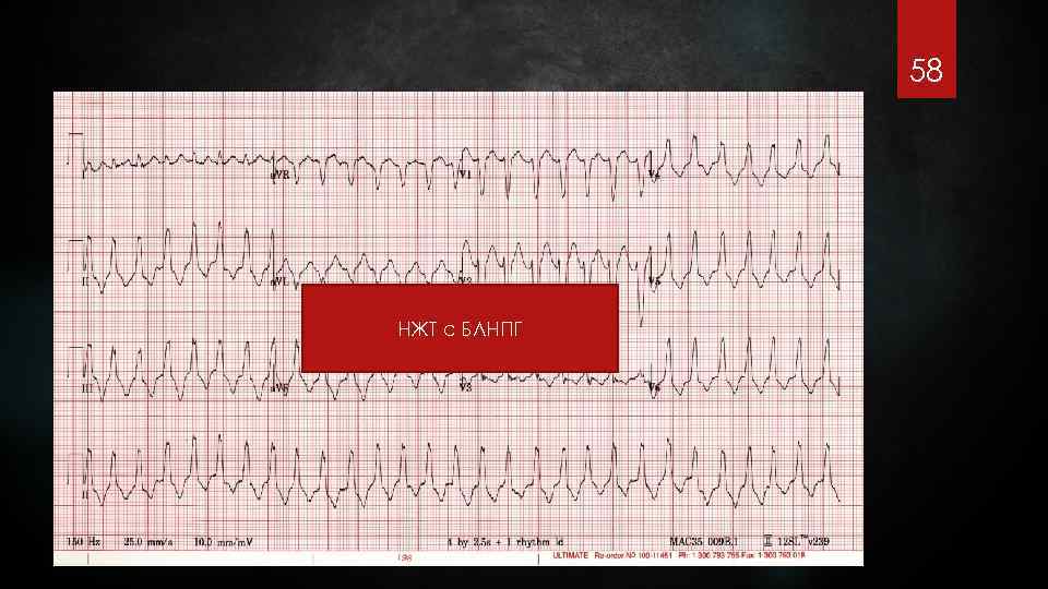 58 НЖТ с БЛНПГ 
