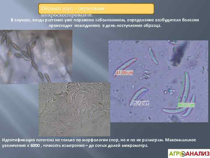 Первый этап – первичное микроскопирование. В случаях, когда растение уже поражено заболеванием, определение возбудителя
