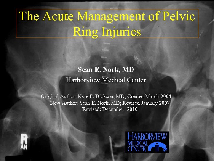 The Acute Management Of Pelvic Ring Injuries Sean