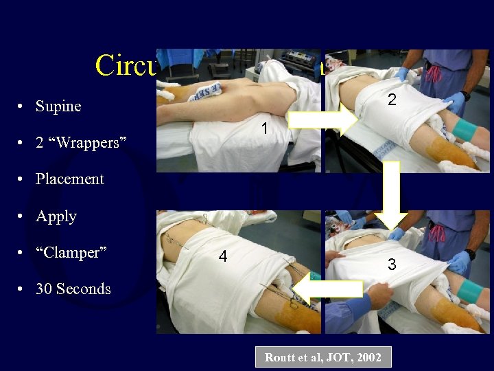 Circumferential Sheeting 2 • Supine 1 • 2 “Wrappers” • Placement • Apply •