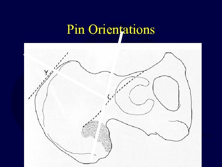 Pin Orientations 