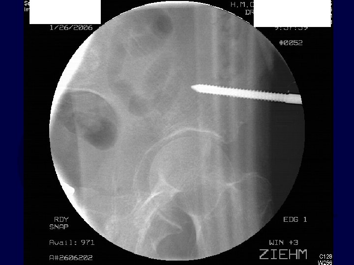  • Iliac Oblique Image 