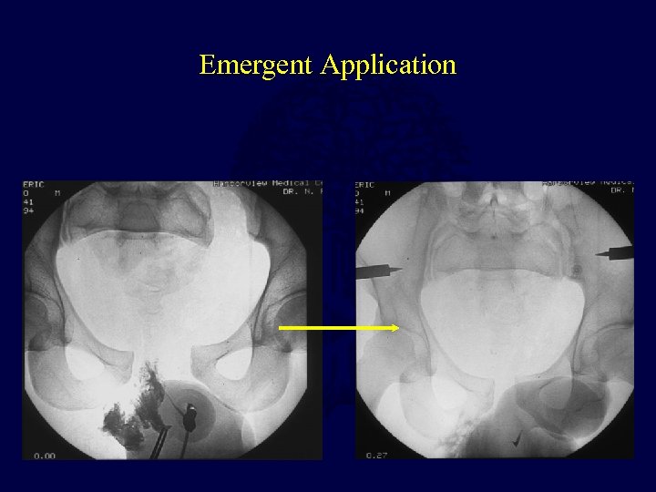 Emergent Application 