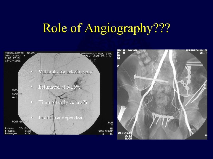 Role of Angiography? ? ? • Valuable for arterial only • Estimated at 5