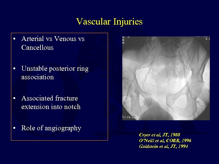 Vascular Injuries • Arterial vs Venous vs Cancellous • Unstable posterior ring association •